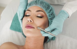 Microneedling